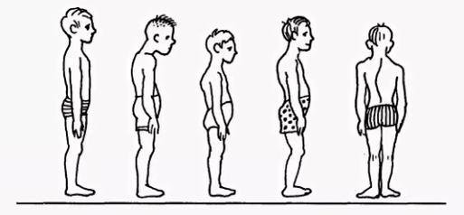 Violation of posture