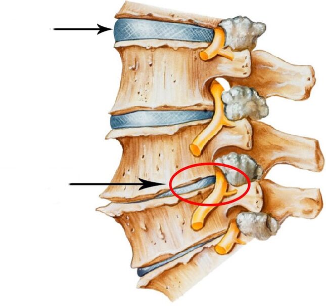 Development of the disc of the disc