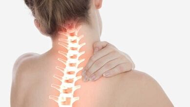 The main manifestations of cervical osteochondosis