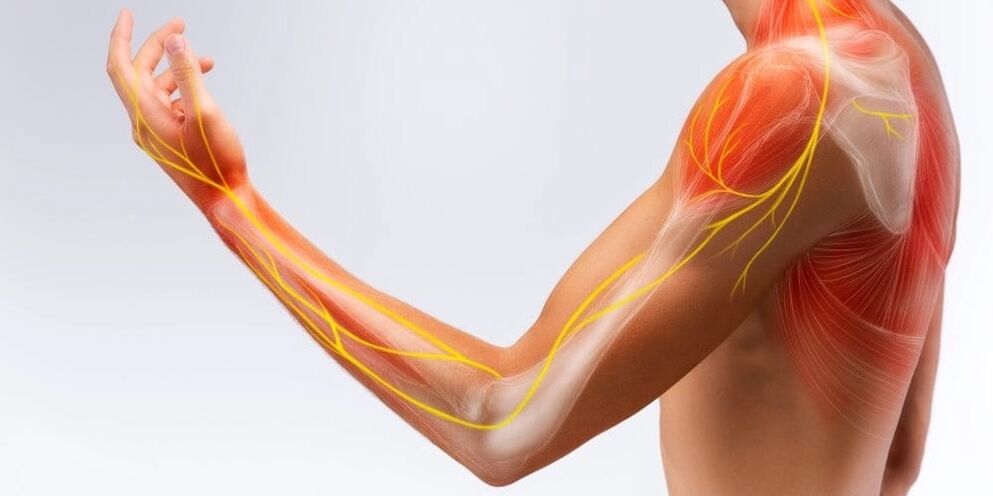 Pain and numbness in the fingers indicate ligament damage due to stenosing ligamentitis